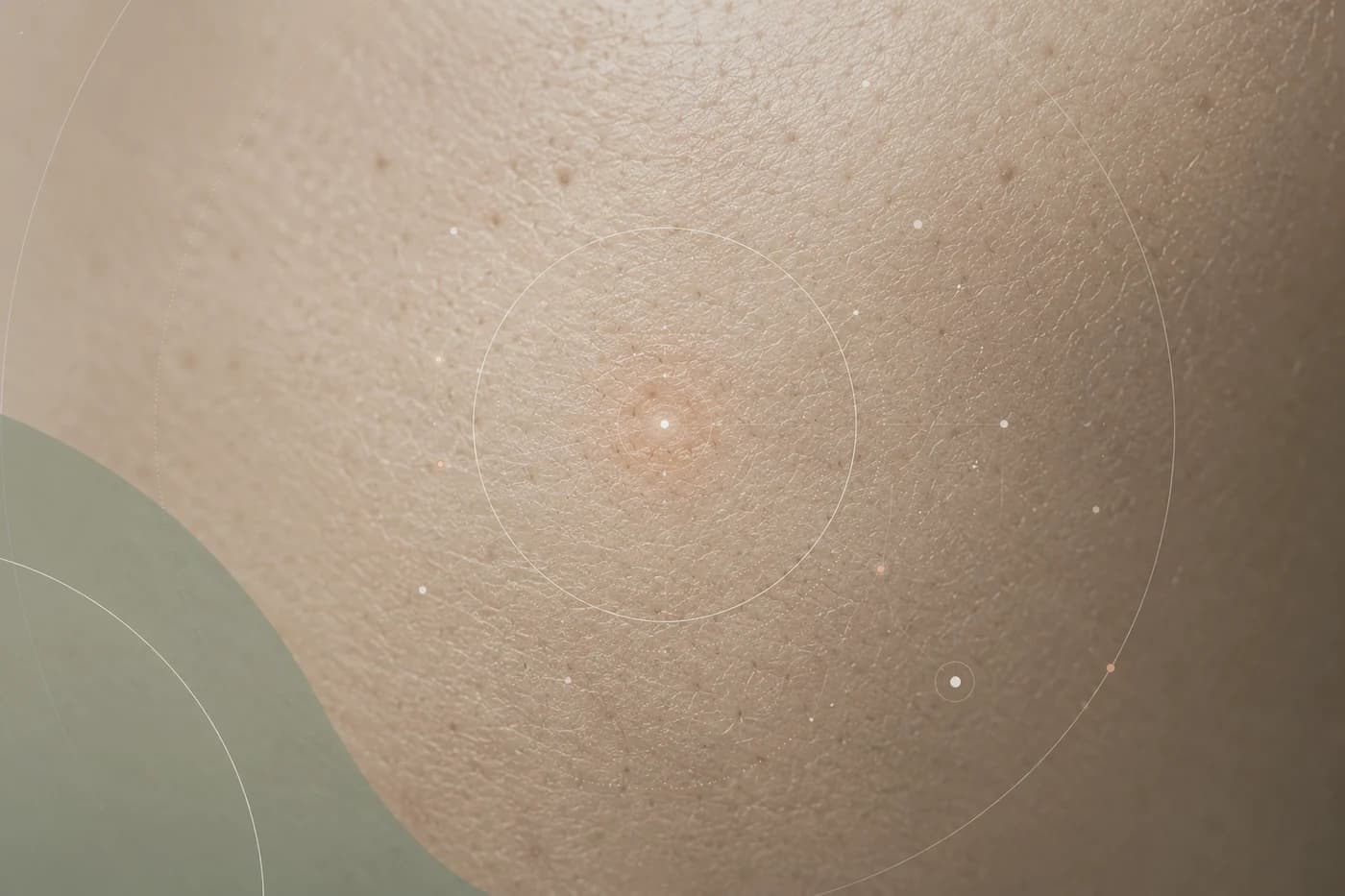 MIRU formula lens visual showing skin texture and signal overlays